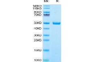 Human IFN-alpha 1 on Tris-Bis PAGE under reduced condition. (IFNA1 Protein (AA 24-189) (Fc Tag))