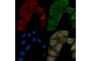 ABIN6258806 and ABIN6276239 staining Hela cells(45 min of heat-shock) by IF/ICC. (MRGPRX3 抗体  (Internal Region))