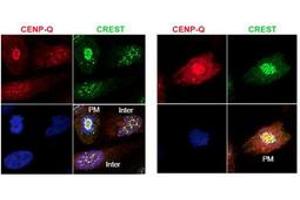 Image no. 2 for anti-Centromere Protein Q (CENPQ) antibody (ABIN1100754) (CENPQ 抗体)