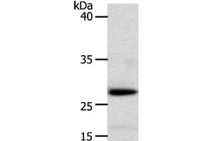 Western Blot analysis of Human liver cancer tissue using RARRES1 Polyclonal Antibody at dilution of 1:300 (RARRES1 抗体)