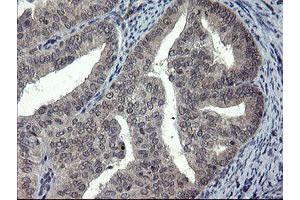 Image no. 1 for anti-Docking Protein 7 (DOK7) antibody (ABIN1497883) (DOK7 抗体)