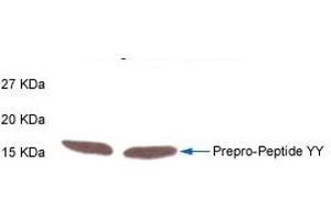 Western Blot Analysis of Prepro-Peptide YY in rat intestine tissue by Rabbit Anti-PYY(3-36)  (Human) Antibody. (Peptide YY 抗体  (AA 3-36))