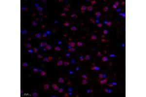 Immunofluorescence of paraffin embedded rat corpus striatum using GPR137A (ABIN7073996) at dilution of 1: 6500 (400x lens) (GPR137 抗体)