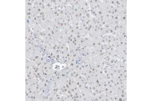 Immunohistochemical staining of human liver with ZFP64 polyclonal antibody  shows nuclear positivity in hepatocytes at 1:200-1:500 dilution. (ZFP64 抗体)