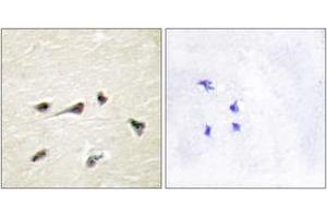 Immunohistochemistry analysis of paraffin-embedded human brain tissue, using AKAP12 Antibody. (AKAP12 抗体  (AA 301-350))