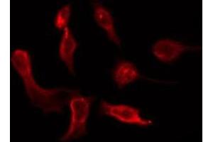 ABIN6276181 staining Hela by IF/ICC. (OR6P1 抗体  (Internal Region))