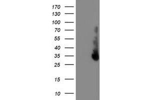 HEK293T cells were transfected with the pCMV6-ENTRY control (Left lane) or pCMV6-ENTRY ERCC1 (Right lane) cDNA for 48 hrs and lysed. (ERCC1 抗体)