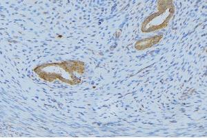 ABIN6268669 at 1/100 staining Human uterus tissue by IHC-P. (IL-5 抗体  (Internal Region))
