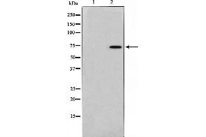 Western blot analysis on 293 cell lysate using TAF6L Antibody，The lane on the left is treated with the antigen-specific peptide. (TAF6L 抗体  (N-Term))