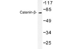Image no. 1 for anti-Catenin (Cadherin-Associated Protein), beta 1, 88kDa (CTNNB1) antibody (ABIN272110) (CTNNB1 抗体)