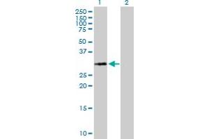 Western Blot analysis of HIST1H1A expression in transfected 293T cell line by HIST1H1A MaxPab polyclonal antibody. (Histone H1.1 抗体  (AA 1-215))