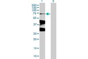 Western Blotting (WB) image for anti-X-Ray Repair Complementing Defective Repair in Chinese Hamster Cells 1 (XRCC1) (AA 1-633) antibody (ABIN521422)