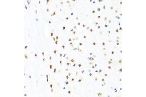 Immunohistochemistry of paraffin-embedded mouse brain using GATA2 antibody. (GATA2 抗体  (AA 1-300))