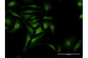 Immunofluorescence of purified MaxPab antibody to CDK6 on HeLa cell. (CDK6 抗体  (AA 1-326))