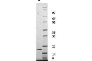 SDS-PAGE of Human Interleukin-1-alpha Recombinant Protein SDS-PAGE Human Interleukin-1-alpha Recombinant Protein. (IL1A 蛋白)
