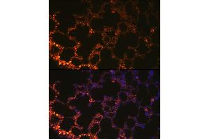 Immunofluorescence (IF) image for anti-Napsin A Aspartic Peptidase (NAPSA) (AA 25-250) antibody (ABIN6144368)