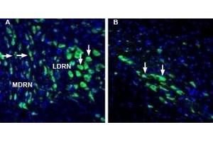Expression of Lynx1 in rat dorsal raphe nucleus and substantia nigra pars compacta - Immunohistochemical staining of perfusion-fixed frozen rat brain sections with Anti-Lynx1 (extracellular) Antibody (ABIN7043310, ABIN7044635 and ABIN7044636), (1:1000), followed by goat anti-rabbit-AlexaFluor-488. (LYNX1 抗体  (Extracellular, N-Term))