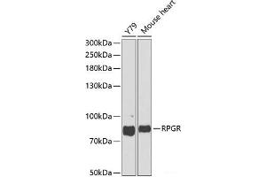 Western blot analysis of extracts of various cell lines using RPGR Polyclonal Antibody at dilution of 1:1000. (RPGR 抗体)