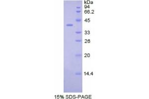 SDS-PAGE analysis of Human CSF2Rb Protein. (CD131 蛋白)