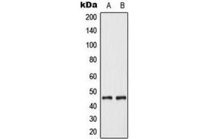 Western blot analysis of Cytokeratin 18 expression in MCF7 (A), Jurkat (B) whole cell lysates. (Cytokeratin 18 抗体  (N-Term))