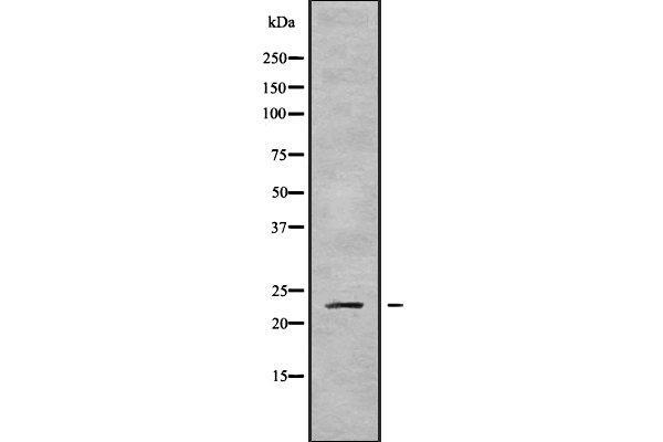 RAB43 抗体  (Internal Region)