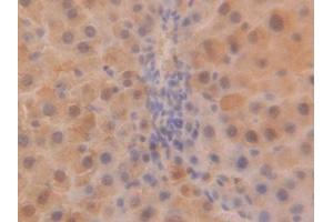 Detection of SOD1 in Rat Liver Tissue using Polyclonal Antibody to Superoxide Dismutase 1 (SOD1) (SOD1 抗体  (AA 2-154))