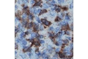 Immunohistochemical analysis of IL-16 staining in human lymph node formalin fixed paraffin embedded tissue section. (IL16 抗体  (N-Term))