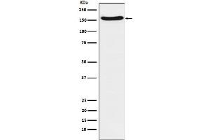 Western blot analysis of FANCA expression in A431 cell lysate.