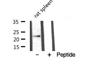 Western blot analysis of extracts from rat spleen , using TNFC antibody. (LTB 抗体  (C-Term))