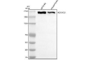 Western blot analysis of IQSEC2 using anti-IQSEC2 antibody (ABIN7599847).