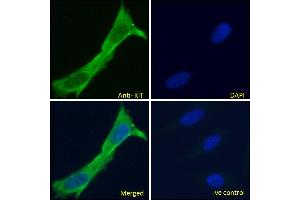 Immunofluorescence (IF) image for anti-Mast/stem Cell Growth Factor Receptor (KIT) (Internal Region) antibody (ABIN1589992)