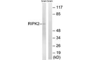 Western blot analysis of extracts from rat brain cells, using RIPK2 (Ab-176) Antibody. (RIPK2 抗体  (AA 146-195))