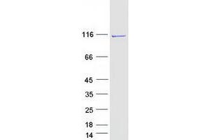 Western Blotting (WB) image for Beaded Filament Structural Protein 1, Filensin (BFSP1) protein (Myc-DYKDDDDK Tag) (ABIN2721199)