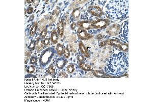 Immunohistochemistry (IHC) image for anti-Pyruvate Kinase, Liver and RBC (PKLR) (N-Term) antibody (ABIN310205) (PKLR 抗体  (N-Term))