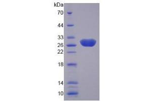 SDS-PAGE analysis of Human Laminin alpha 4 Protein. (LAMa4 蛋白)