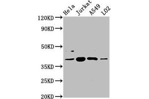 Western Blot Positive WB detected in: Hela whole cell lysate, Jurkat whole cell lysate, A549 whole cell lysate, LO2 whole cell lysate All lanes: SHARPIN antibody at 5. (SHARPIN 抗体  (AA 82-171))