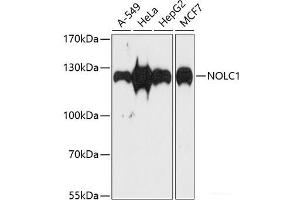Western blot analysis of extracts of various cell lines using NOLC1 Polyclonal Antibody at dilution of 1:1000. (NOLC1 抗体)
