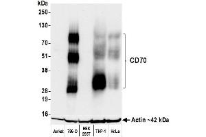 Western Blotting (WB) image for anti-CD70 Molecule (CD70) (AA 50-193) antibody (ABIN7795664)