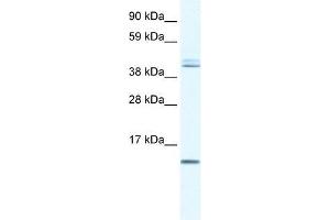 Human Liver; WB Suggested Anti-TSFM Antibody Titration: 0. (TSFM 抗体  (N-Term))