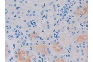 Immunohistochemistry (IHC) image for anti-Prolactin-Induced Protein (PIP) (AA 41-139) antibody (ABIN7443821)