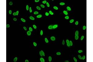 Immunofluorescence staining of Hela cells with ABIN7139612 at 1:15, counter-stained with DAPI. (HIST1H1C 抗体  (meLys96))
