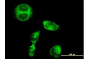 Immunofluorescence of purified MaxPab antibody to SRGAP1 on HeLa cell. (SRGAP1 抗体  (AA 1-1085))