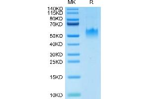 SDS-PAGE (SDS) image for Poliovirus Receptor-Related Immunoglobulin Domain Containing (PVRIG) (AA 41-171) protein (Fc Tag) (ABIN7275505)