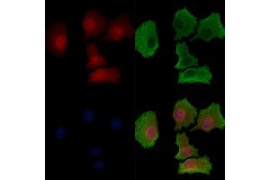 Phospho-SGK1 (Ser78) Antibody staining HepG2 cells(serum starvation treatment) by IF/ICC. (SGK1 抗体  (pSer78))