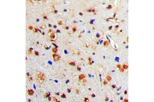 Immunohistochemical analysis of Tyrosine Hydroxylase (pS71) staining in human brain formalin fixed paraffin embedded tissue section. (Tyrosine Hydroxylase 抗体  (N-Term, pSer71))