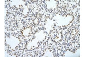 Rabbit Anti-UTP18 antibody Catalog Number: ARP40821  Paraffin Embedded Tissue: Human Lung cell Cellular Data: alveolar cell of renal tubule Antibody Concentration: 4. (UTP18 抗体  (N-Term))