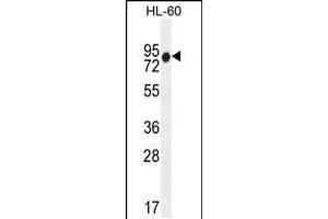 Western blot analysis in HL-60 cell line lysates (35ug/lane). (ZNF665 抗体  (N-Term))