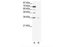 Image no. 1 for anti-Zinc Finger Protein 326 (ZNF326) (AA 469-518) antibody (ABIN203092) (ZNF326 抗体  (AA 469-518))
