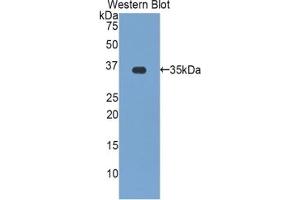Detection of Recombinant zAP70, Human using Polyclonal Antibody to Zeta Chain Associated Protein Kinase 70 kDa (zAP70) (ZAP70 抗体  (AA 337-600))