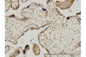 Image no. 1 for anti-Mitogen-Activated Protein Kinase-Activated Protein Kinase 3 (MAPKAPK3) (AA 272-382) antibody (ABIN599019) (MAPKAP Kinase 3 抗体  (AA 272-382))
